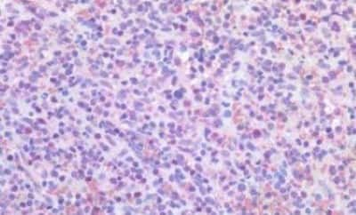 Immunohistochemistry-Paraffin: PIM1 Antibody [NBP3-14446] - Human Spleen: Formalin-Fixed, Paraffin-Embedded (FFPE)